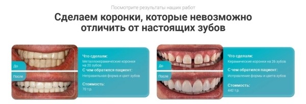 Кейс по стоматологии. Как вырасти пятикратно с 1.500.000 руб до 8.500.000 руб
Кейс по стоматологии. Как вырасти пятикратно с 1.500.000 руб до 8.500.000 руб