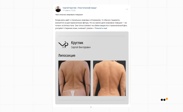 Как выстроить канал продаж ВКонтакте для пластического хирурга, который за 9 месяцев принес более 30 миллионов рублей             
                    Как выстроить канал продаж ВКонтакте для пластического хирурга, который за 9 месяцев принес более 30 миллионов рублей