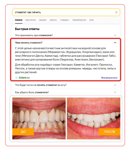 
                    Люди стали чаще лечить зубы: как стоматологиям пользоваться этим и продвигаться в поиске            